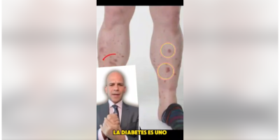 Rivera para promocionar