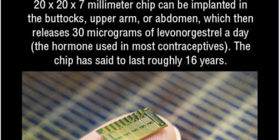 Birth Control Microchip