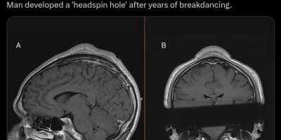 Headspin Hole